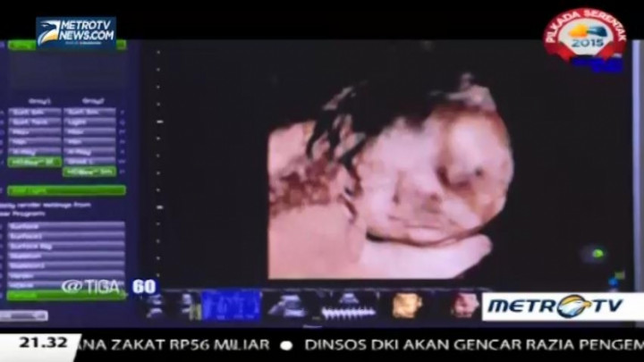 Ibu Hamil Harus Membatasi Gerakan Fisik, Mitos atau Fakta?