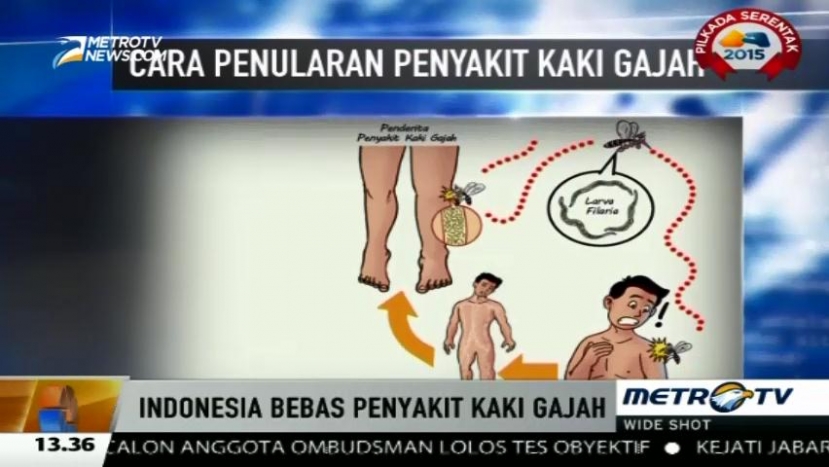 Kenali Cara Penularan Penyakit Kaki Gajah 