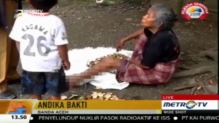 Penyakit Kaki Gajah Jadi Kejadian Luar Biasa di Aceh Barat