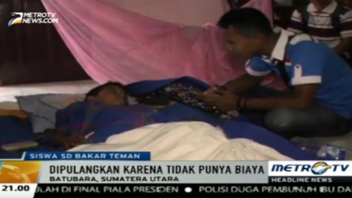  Tak Punya Biaya, Siswa SD Dibakar Teman Dipulangkan Rumah Sakit 