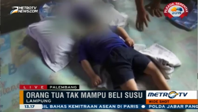 Bayi Tanpa Tempurung di Lampung Tidak Mendapat Perawatan Layak