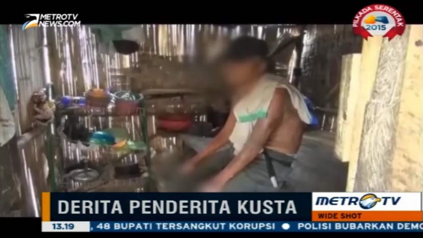 Menderita Kusta, Romli 35 Tahun Tinggal di Kandang Ayam