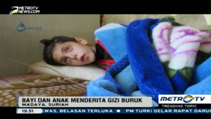 Miris, Begini Kondisi Anak-anak yang Kelaparan di Suriah 
