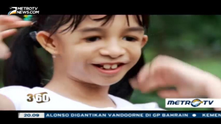 Fenomena Penyakit Langka di Indonesia