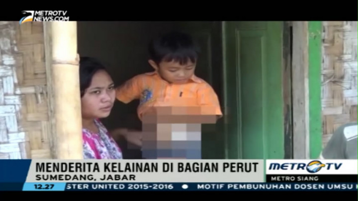 Seorang Balita di Sumedang Menderita Kelainan Usus