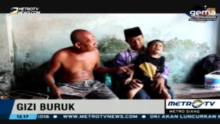 Gizi Buruk, Bocah 9 Tahun Belum Bisa Berjalan
