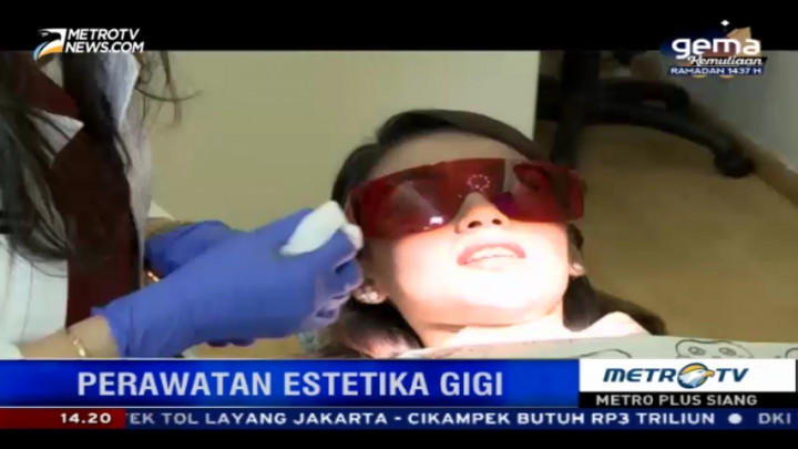 Perawatan Estetika Gigi