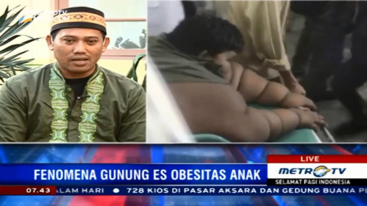 Penanganan Obesitas Arya Sempat Terkendala Biaya