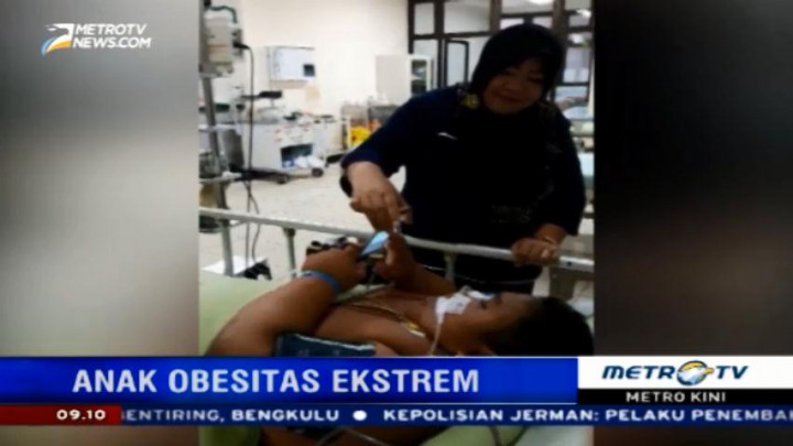 Kondisi Bocah Obesitas Asal Palembang Berangsur Membaik