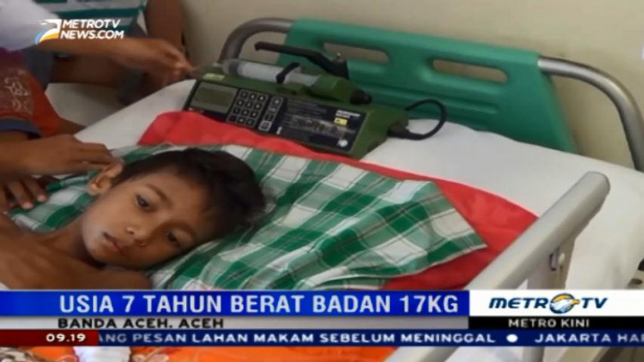 Gizi Buruk, Bocah di Aceh Beratnya Hanya 17 Kg