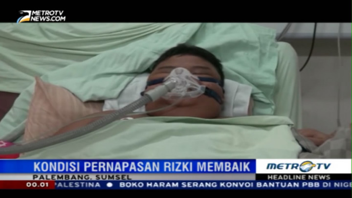 Berat Badan Bocah Obesitas Asal Palembang Turun 21 Kg