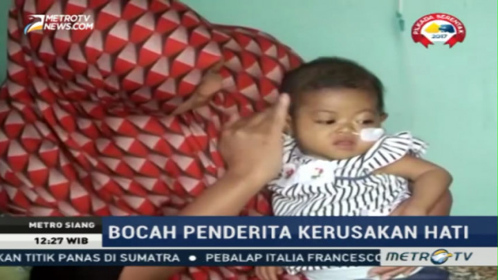 Bayi Ini Bertahan Hidup dengan Hati & Empedu Rusak