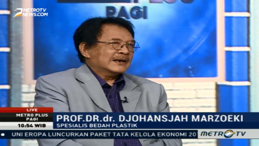 Operasi Celah Bibir dan Langit-langit (3)