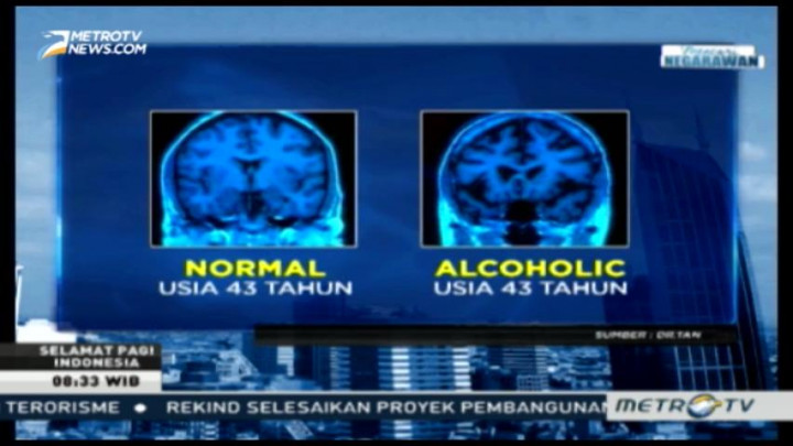 Efek Kecanduan Miras Terhadap Otak