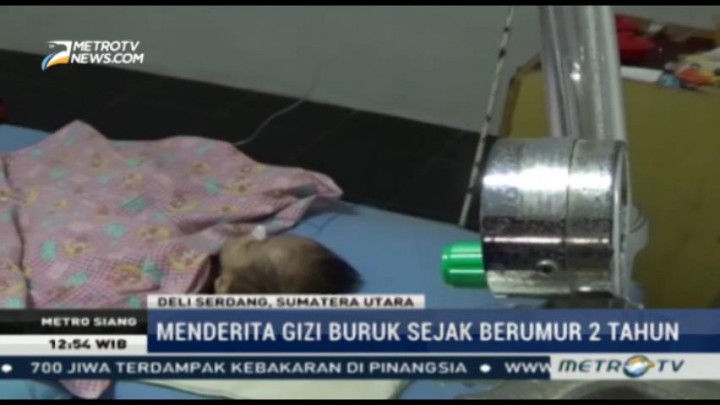 Derita Gizi Buruk, Anak Ini Beratnya Hanya 6 Kg