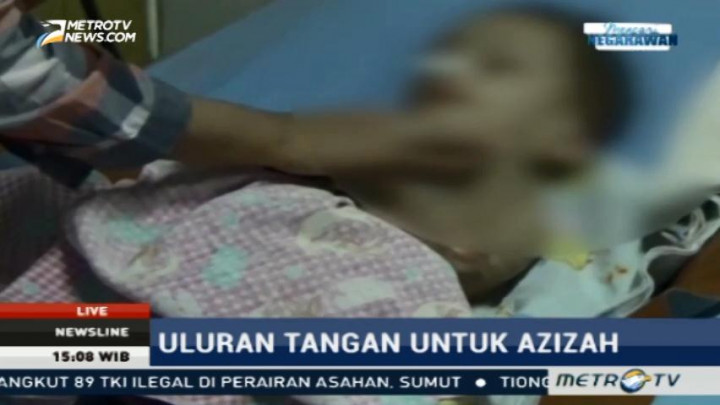 Azizah, Penderita Gizi Buruk di Deli Serdang Mendapat Bantuan