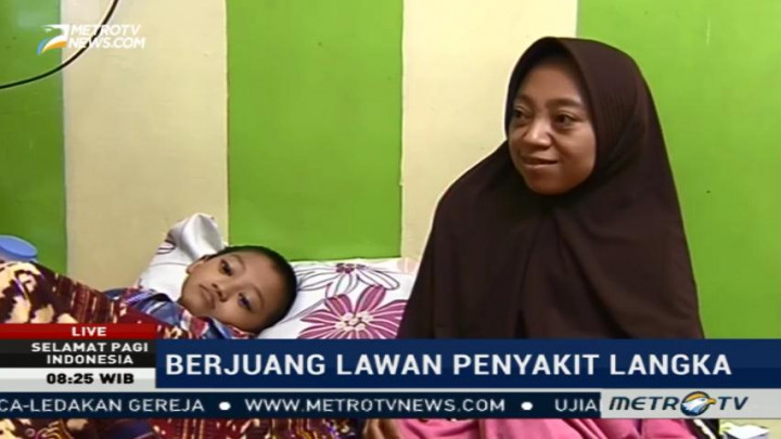 Kisah Fahri Berjuang Melawan Penyakit Osteogenesis Imperfecta