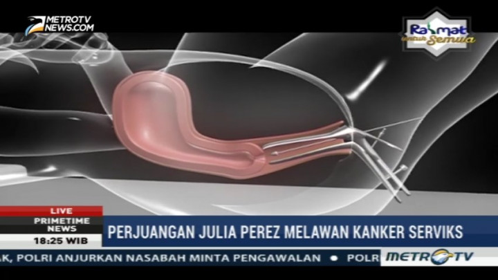 Begini Cara Mendeteksi Kanker Serviks