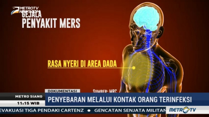 Mengenal MERS, Sindrom Pernapasan Timur Tengah