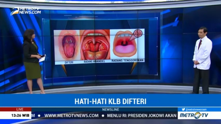 Kenali Perbedaan Difteri, Amandel dan Radang Tenggorokan