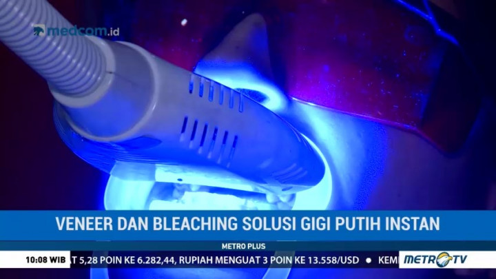 Mengenal Perbedaan Veneer dan Bleaching