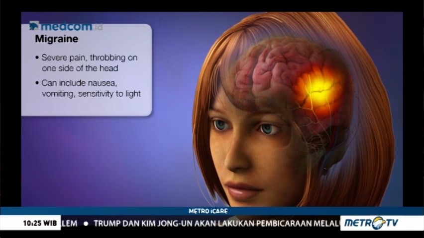 Sering Sakit Kepala Gejala Stroke?