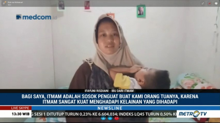 Anak Ini Alami Kelainan Pada Sejumlah Organ Tubuhnya