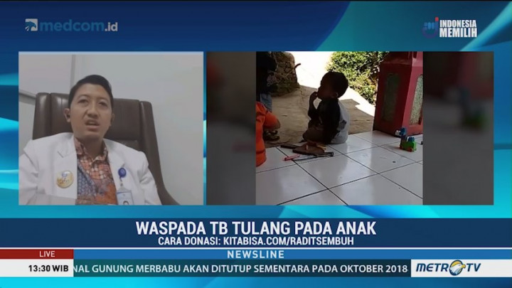 Kisah Bocah Radit Berjuang Melawan TBC Tulang