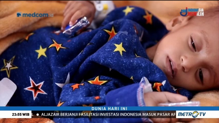 Lebih dari 85 Ribu Balita di Yaman Tercancam Kelaparan