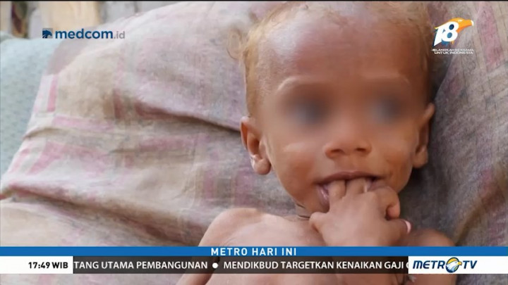 Bencana Kemanusiaan di Yaman