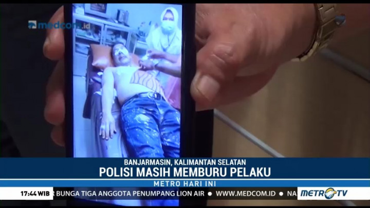 Polisi Buru Pelaku Penyiraman Air Keras Terhadap Kadiv Pemasyarakatan Kalsel