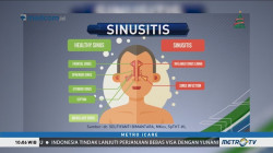 Waspada Penyakit Sinusitis (1)