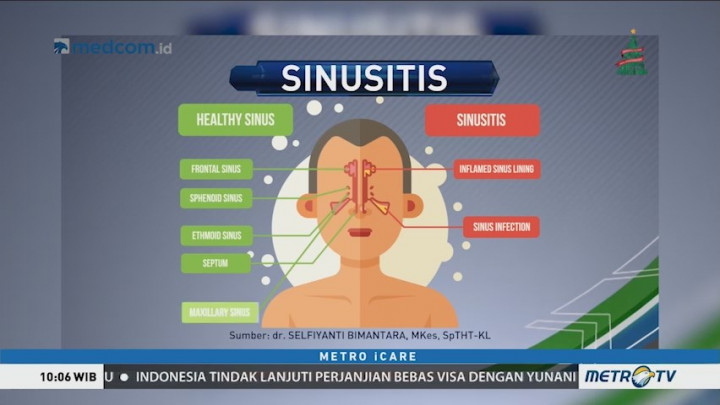 Waspada Penyakit Sinusitis (1)