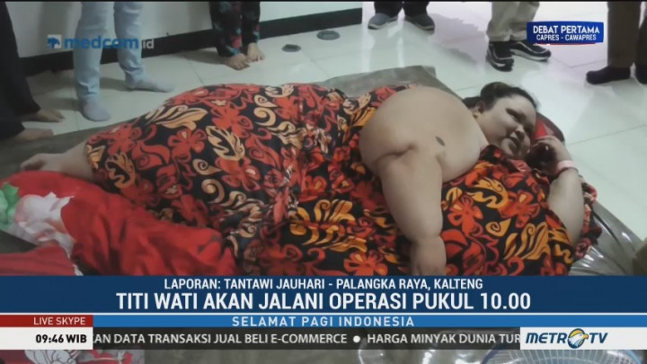 Titi Wati Jalani Operasi Pukul 10.00 WIB