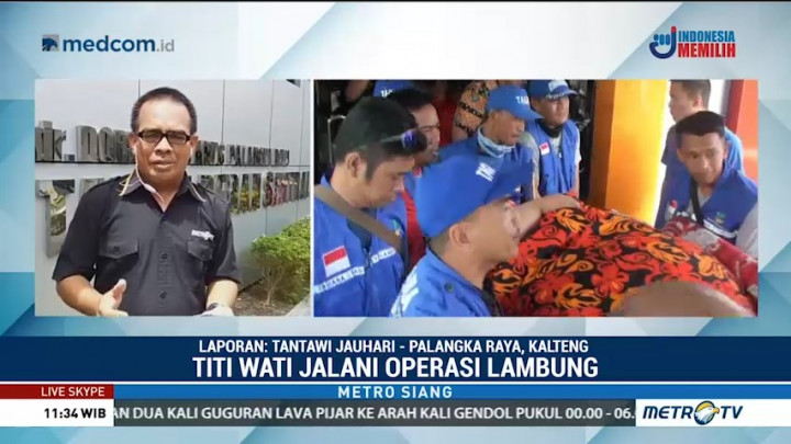 Operasi Titi Wati Melibatkan 16 Dokter