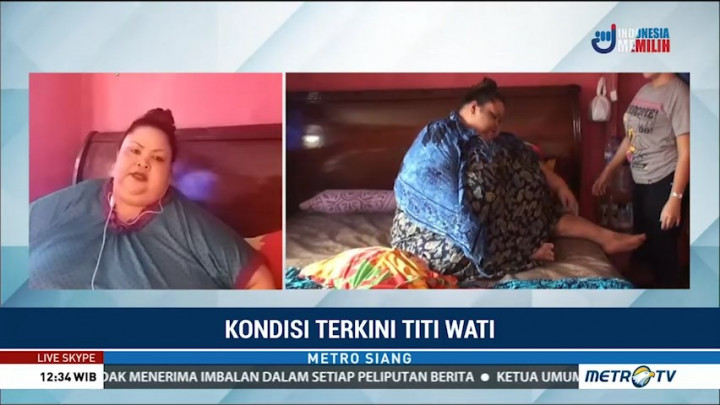 Kondisi Terkini Titi Wati, Penderita Obesitas Asal Palangkaraya