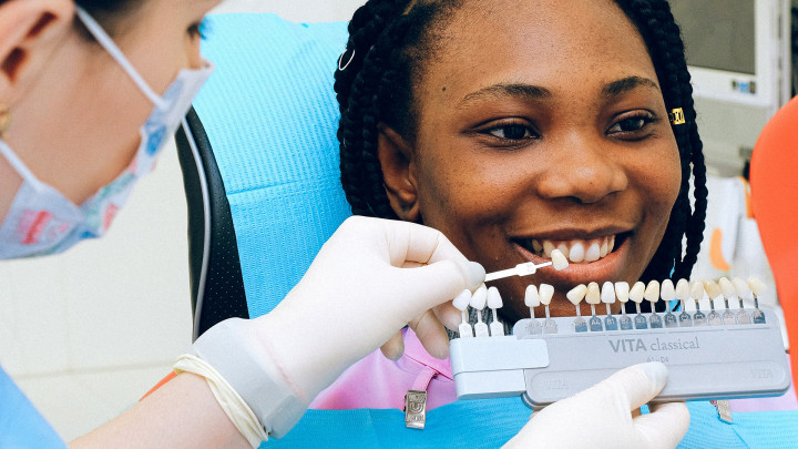 Faktor yang Mempengaruhi Warna Gigi Seseorang