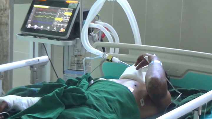 Kesal Motor Rusak Usai Dipinjam, Pria di Tapanuli Bakar Temannya Sendiri