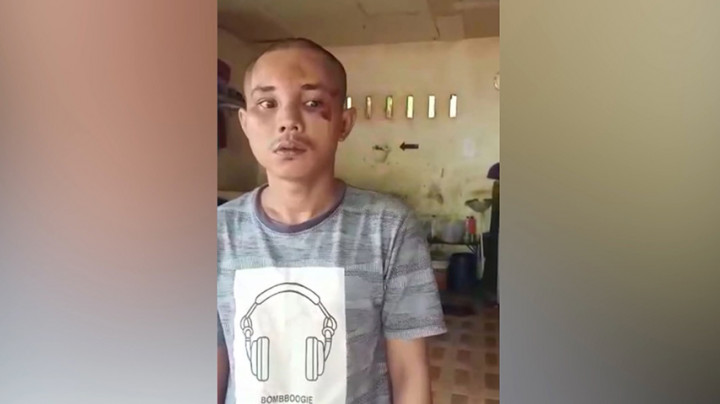 Fakta Baru Terkait Kerangkeng Manusia Bupati Langkat, Komnas HAM: Lebih dari 1 Orang Tewas