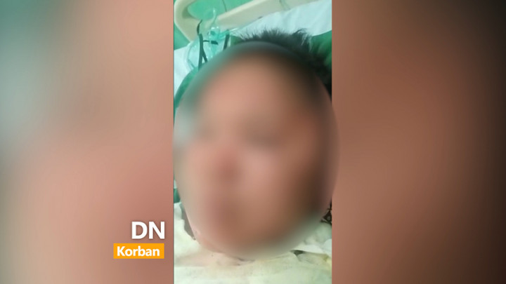 Pengakuan Korban Pembakaran oleh Oknum Polisi di Muara Enim