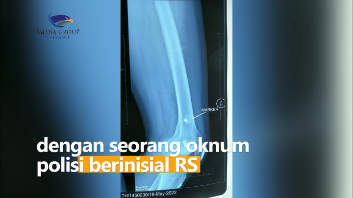 Warga Tambakrejo Terkena Tembakan Oleh Polisi