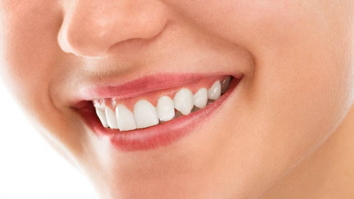 Ingin Gigi Bersih dan Sehat? Konsumsi Jenis Makanan Ini