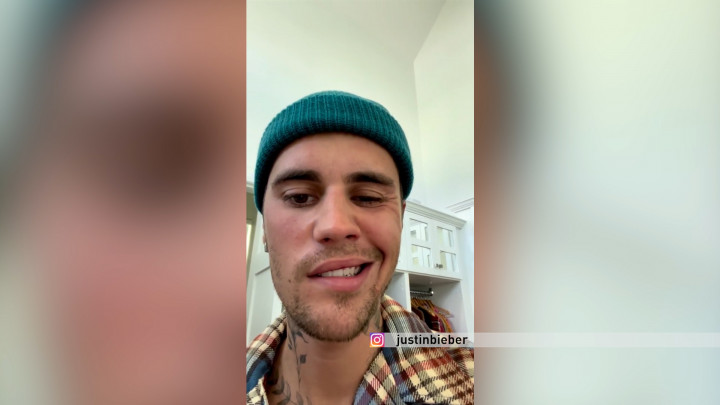 Wajah Alami Kelumpuhan Sebelah, Justin Bieber Terpaksa Tunda Konser