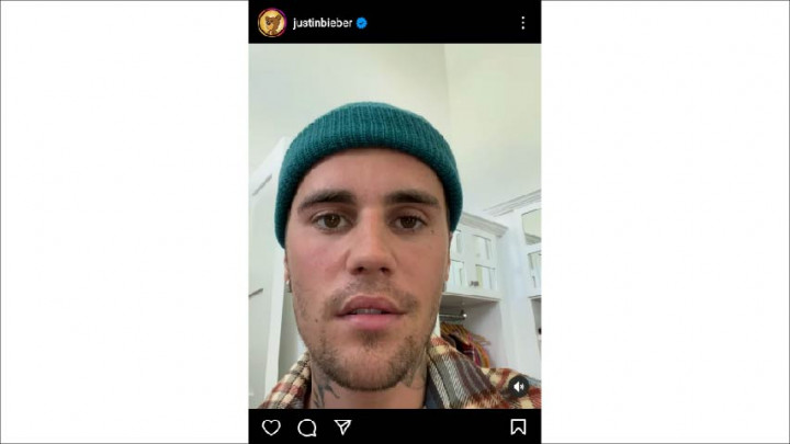 Mengenal Ramsay Hunt Syndrome, Penyakit yang Dialami Justin Bieber