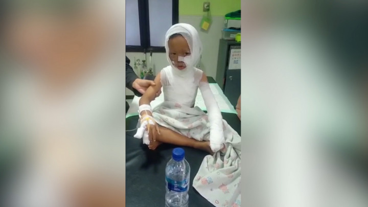 Bocah di Ponorogo Terbakar Jajanan Es Asap