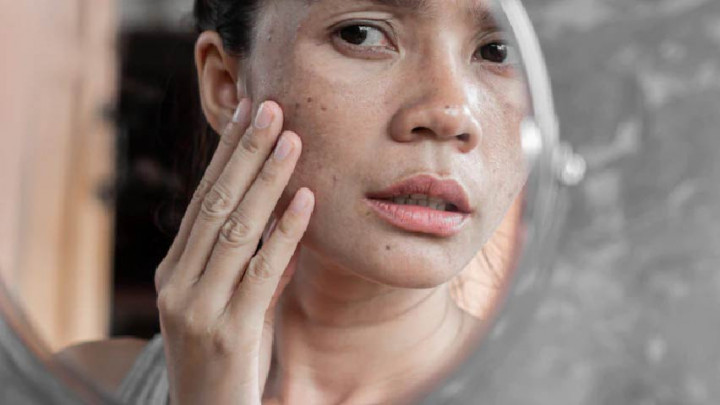 Rawat Kulit Kering dari Dalam dengan Konsumsi Makanan Ini