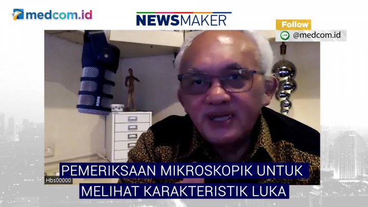 Penjelasan Guru Besar Soal Pemeriksaan Mikroskopik pada Jenazah Brigadir J