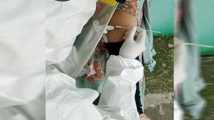 Warga Cilegon Suspek Cacar Monyet