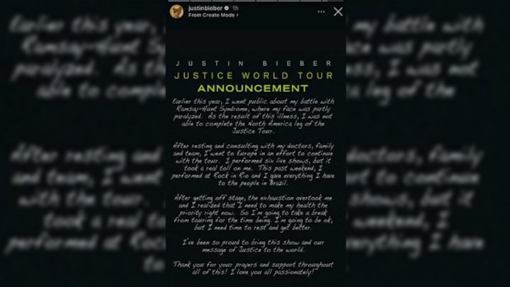 Justin Bieber Umumkan Rehat dari Tur Dunia