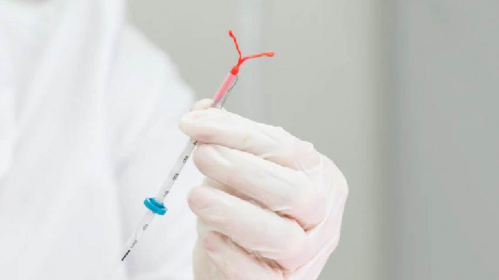 Kontrasepsi IUD, Pilihan Efektif untuk Cegah Kehamilan